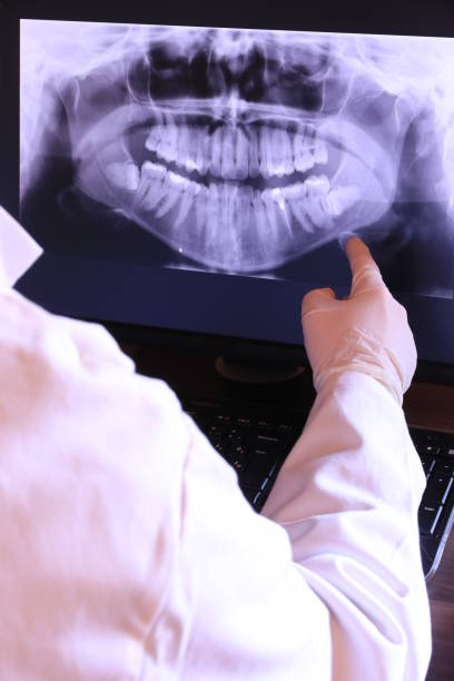 Best Emergency Dental Care for Broken or Chipped Teeth in East Riverdale, MD