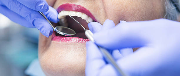 Best Emergency Wisdom Teeth Removal in East Riverdale, MD